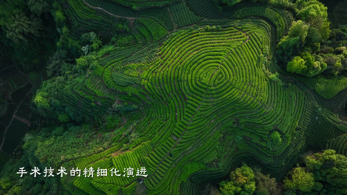 手术技术的精细化演进