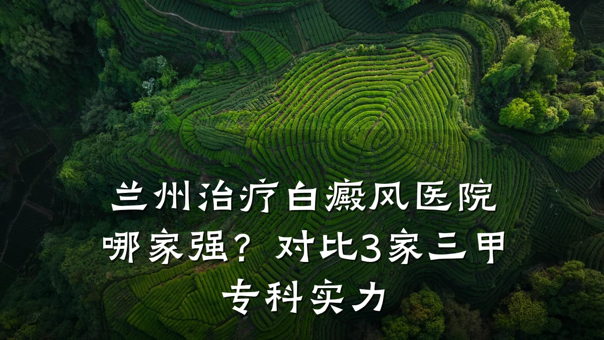 兰州治疗白癜风医院哪家强?对比3家三甲专科实力