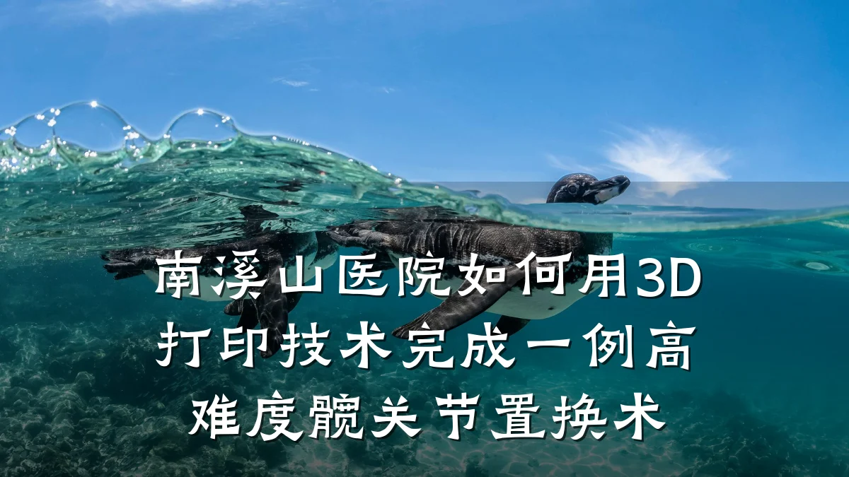 南溪山医院如何用3D打印技术完成一例高难度髋关节置换术