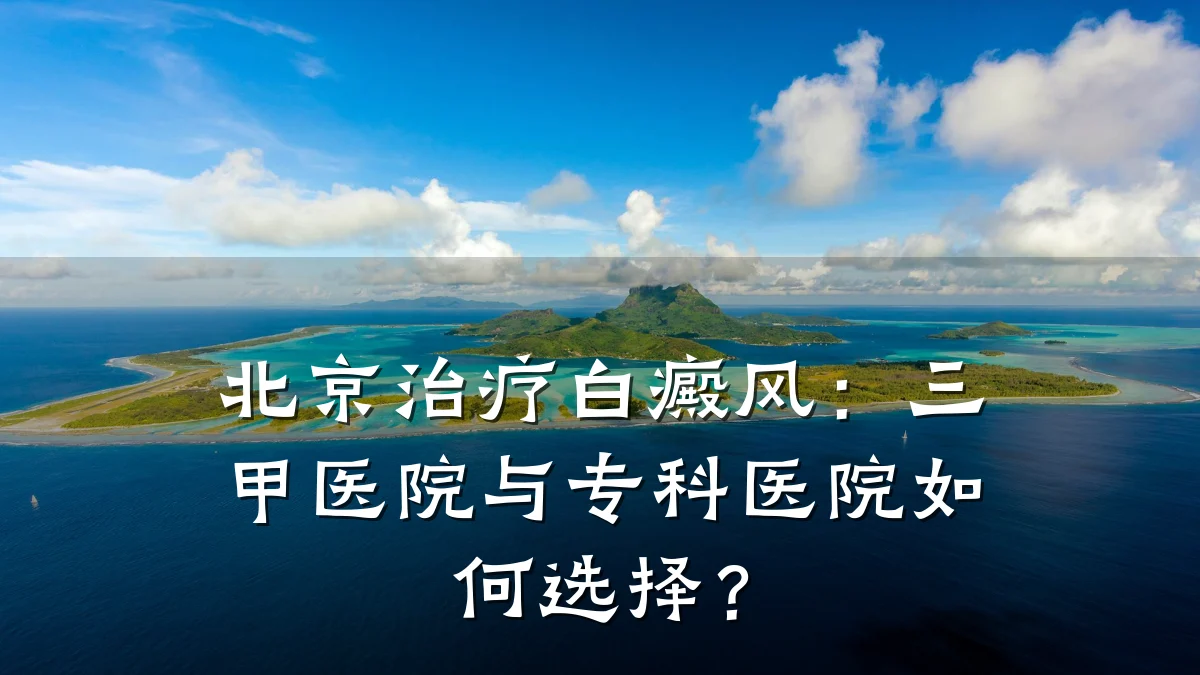 北京治疗白癜风:三甲医院与专科医院如何选择?
