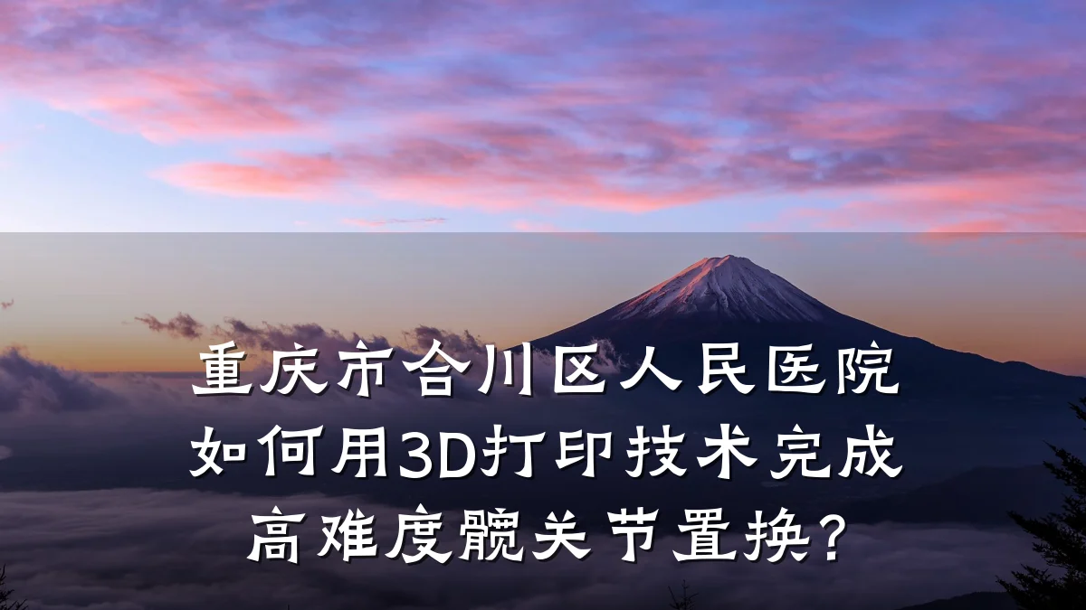 重庆市合川区人民医院如何用3D打印技术完成高难度髋关节置换？