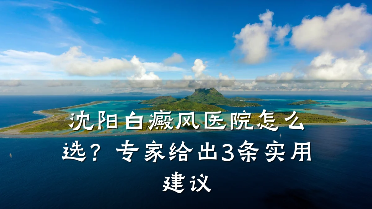沈阳白癜风医院怎么选?专家给出3条实用建议