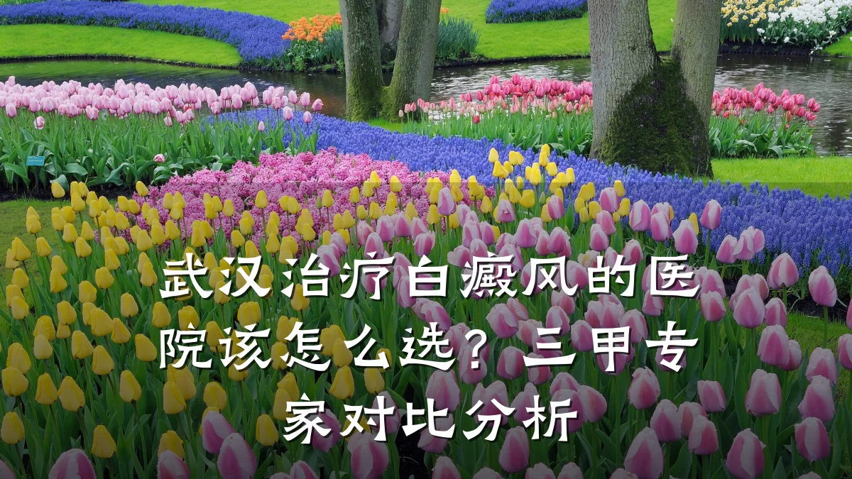 武汉治疗白癜风的医院该怎么选?三甲专家对比分析