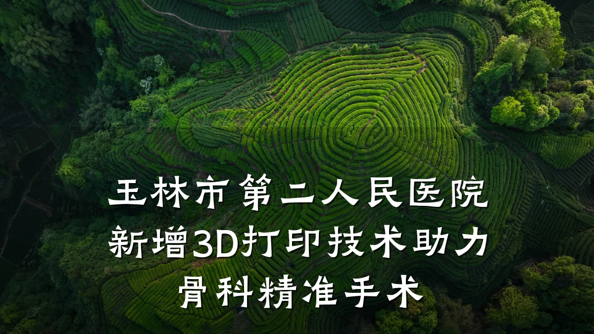 玉林市第二人民医院新增3D打印技术助力骨科精准手术