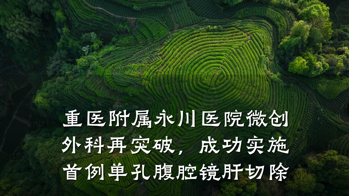 重医附属永川医院微创外科再突破,成功实施首例单孔腹腔镜肝切除