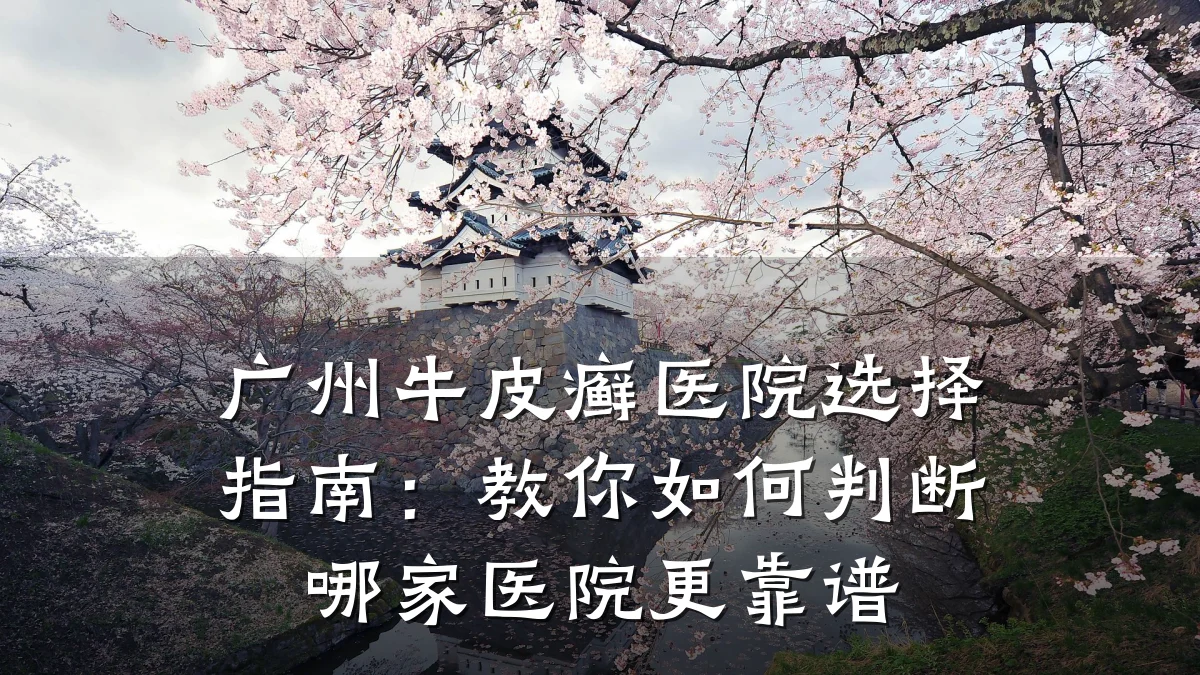 广州牛皮癣医院选择指南:教你如何判断哪家医院更靠谱