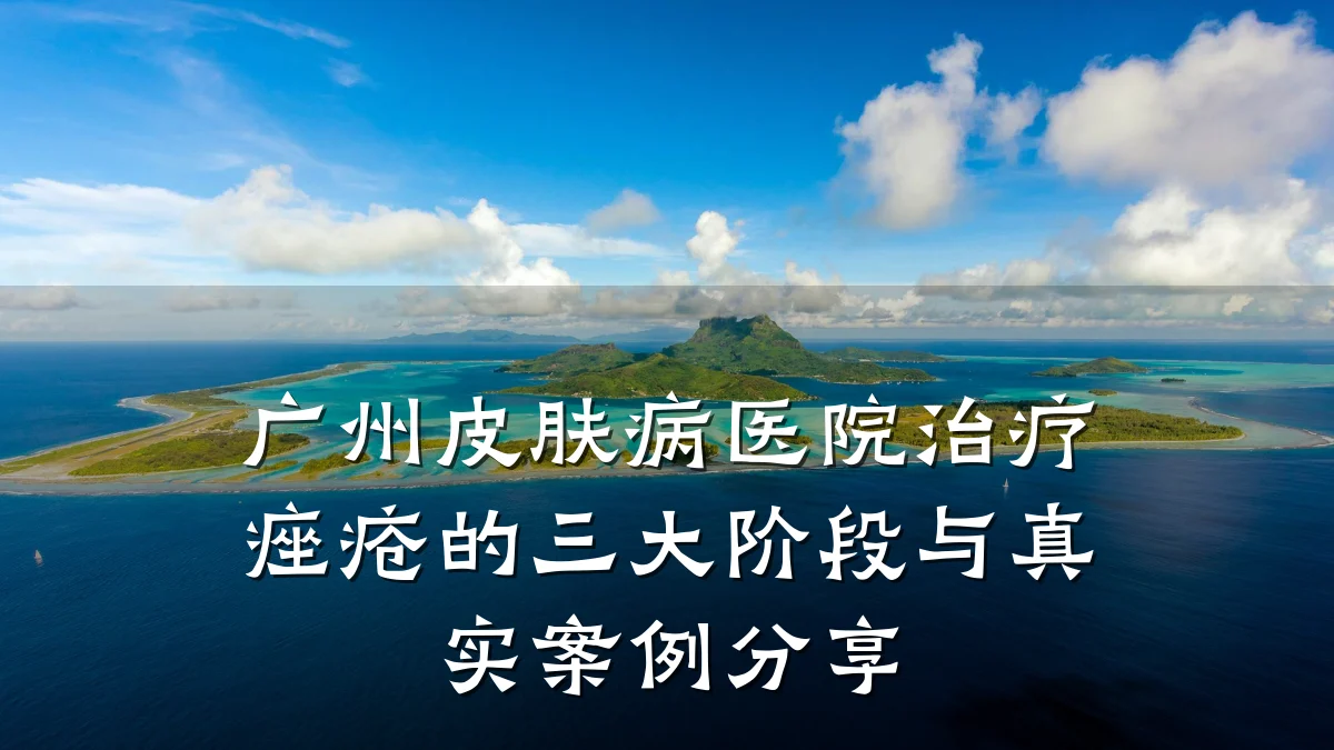 广州皮肤病医院治疗痤疮的三大阶段与真实案例分享