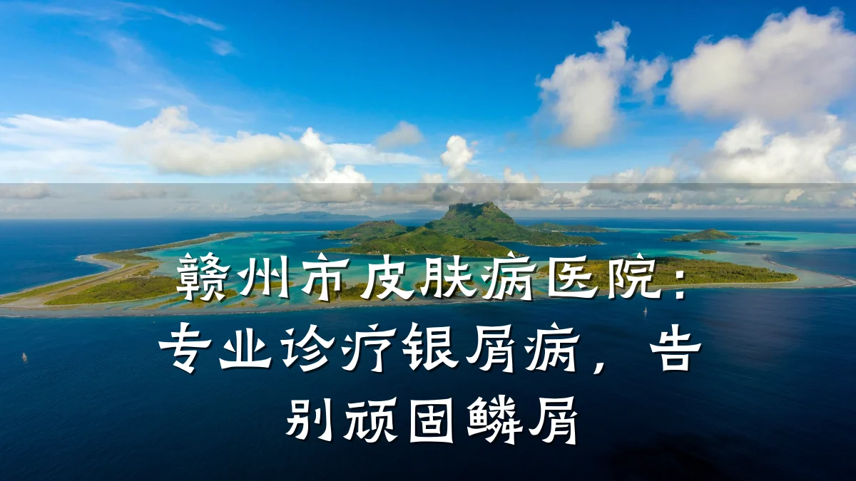 赣州市皮肤病医院:专业诊疗银屑病,告别顽固鳞屑
