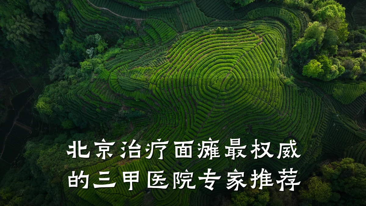 北京治疗面瘫最权威的三甲医院专家推荐