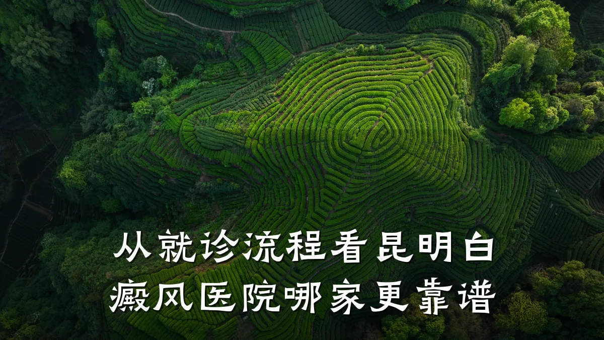 从就诊流程看昆明白癜风医院哪家更靠谱