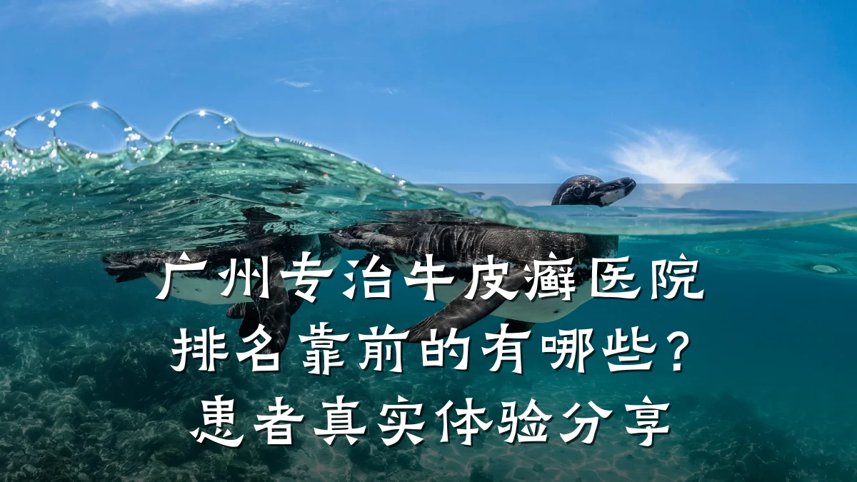 广州专治牛皮癣医院排名靠前的有哪些?患者真实体验分享